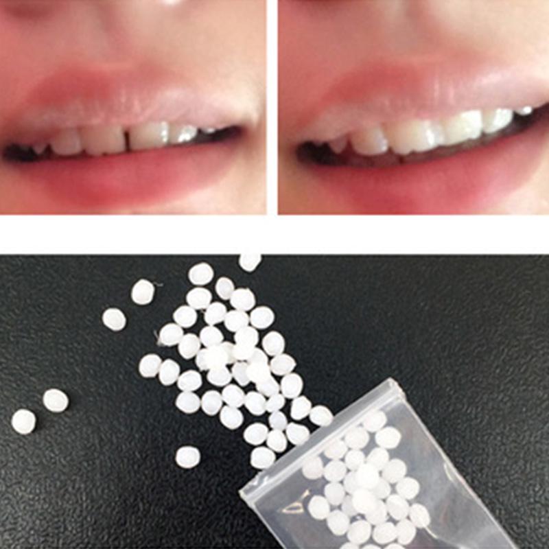 Teeth Gap Filler – Temporary Tooth Repair Kit for Missing, Chipped & Broken Teeth