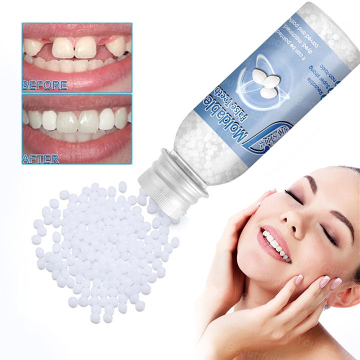 Teeth Gap Filler – Temporary Tooth Repair Kit for Missing, Chipped & Broken Teeth